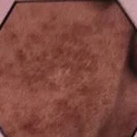 Pigmentation on the skin